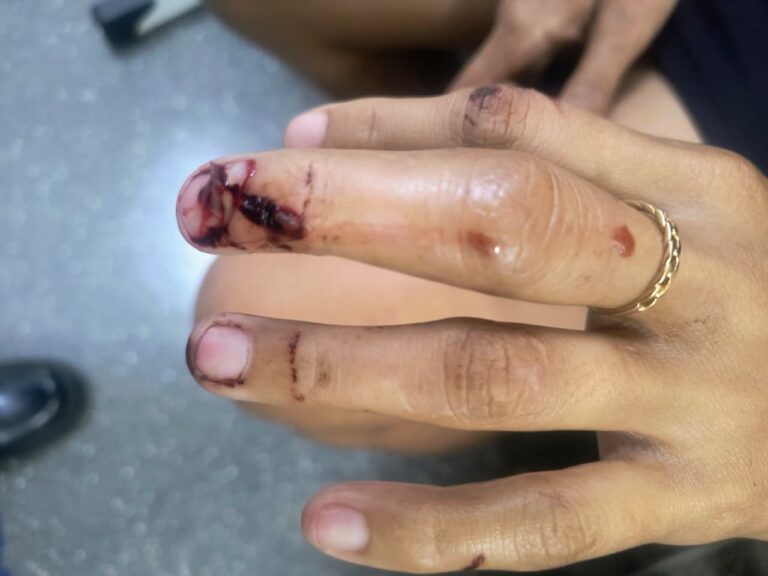 Grávida fica ferida após ser agredida por vizinha em Primavera do Leste